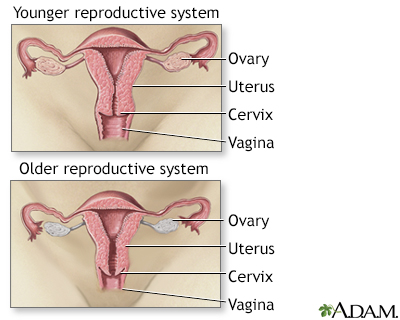 Menopause