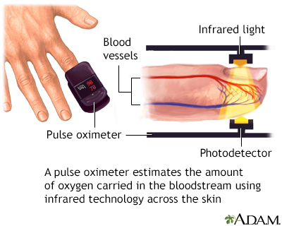 Pulse oximeter