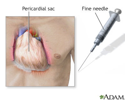 Pericardium