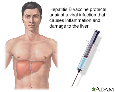 Hepatitis B